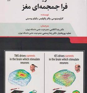 کتاب تحریک فراجمجمه ای مغز